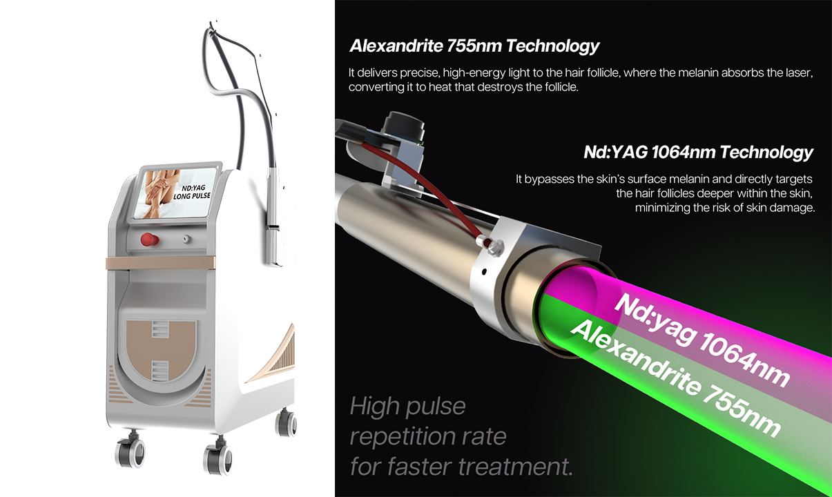 nd yag alexandrite laser hair removal machine