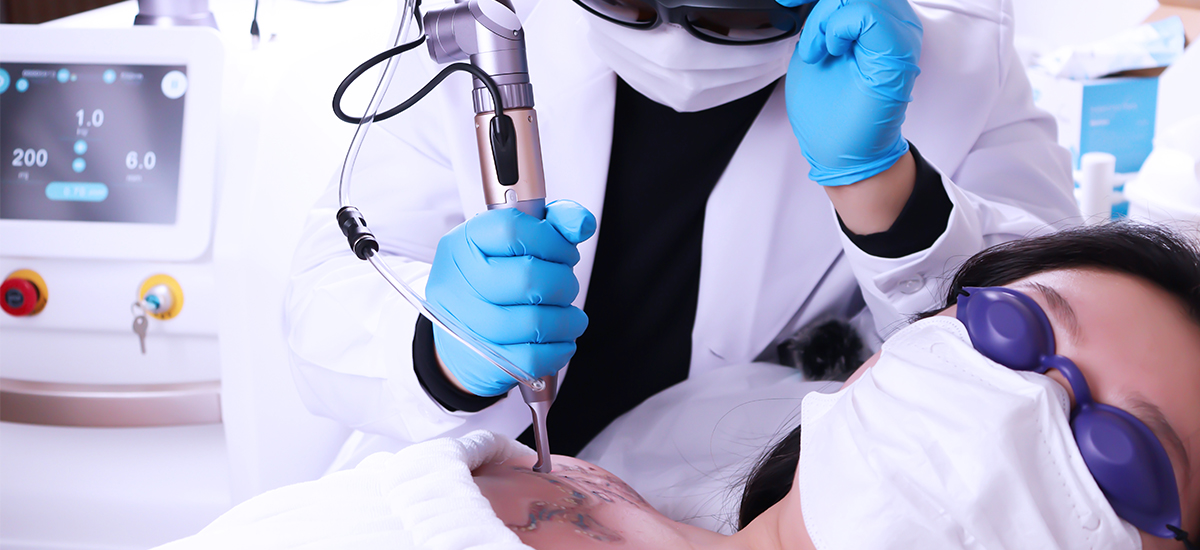 laser tattoo removal effect